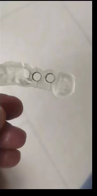 Resina dental impressora 3d gu - 3D Printing Dental avaliação e preço