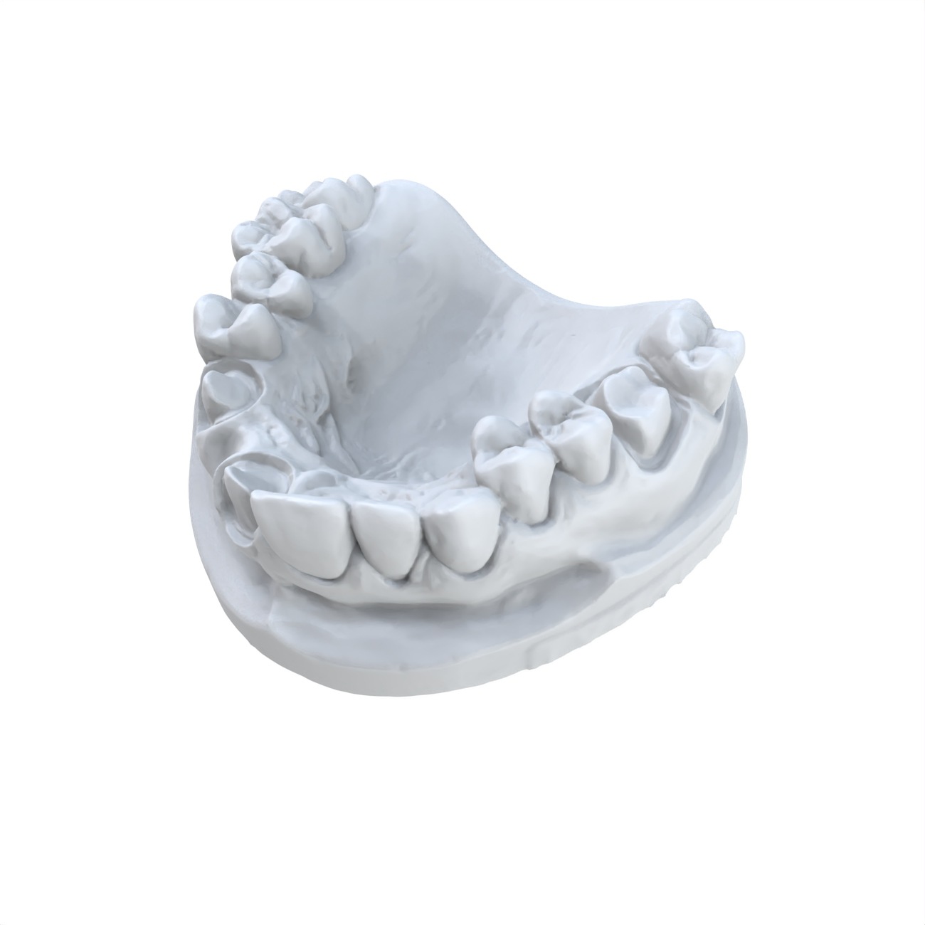 1 peça modelo dentário impress - 3D Printing Dental avaliação e preço
