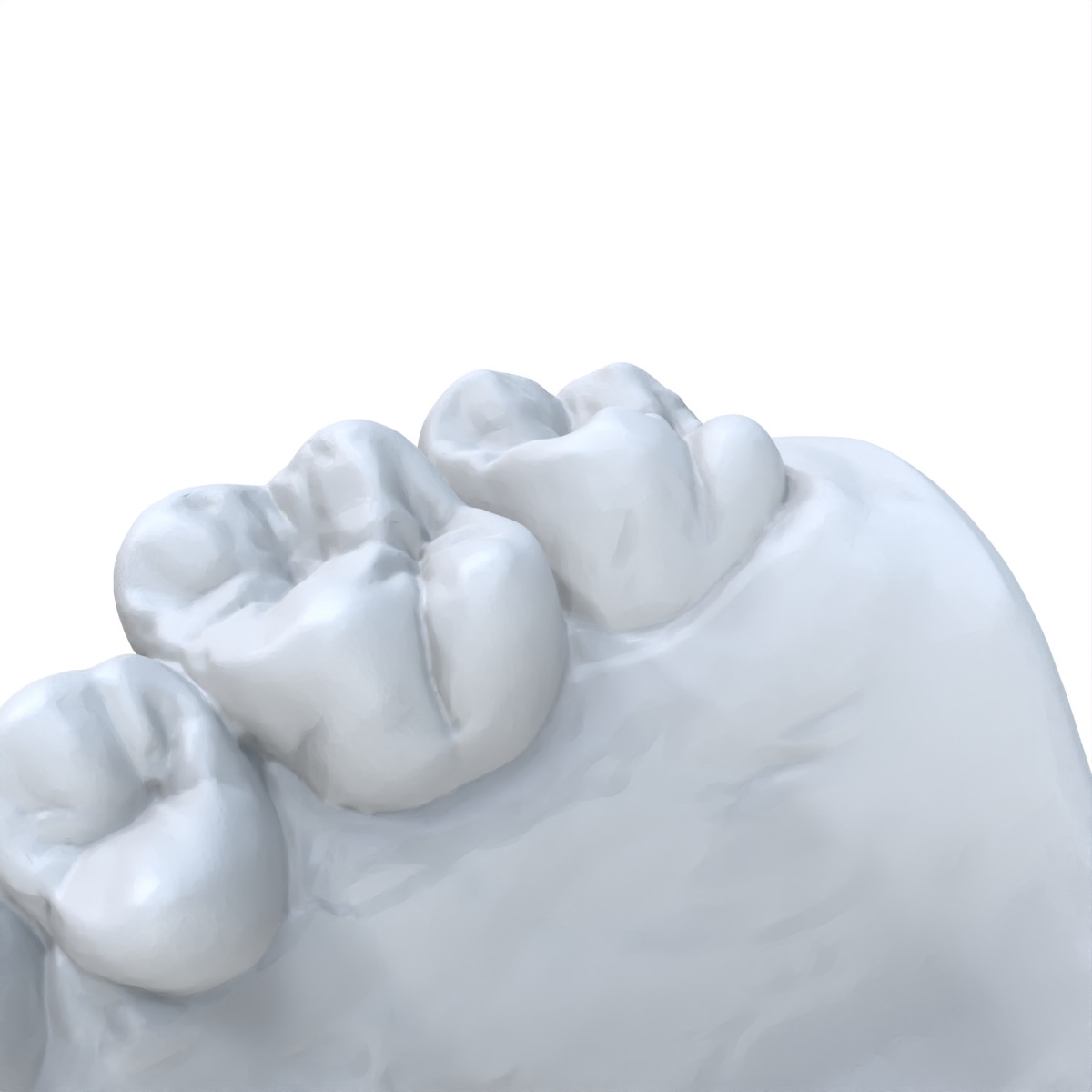 1 peça modelo dentário impress - 3D Printing Dental avaliação e preço